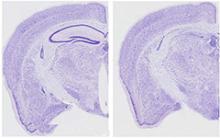 Sections of brains from normal (left) and tauopathy (right) mice. The dark purple lines in the left image represent the hippocampus, the area most responsible for learning and memory. This structure is almost completely absent in the right image