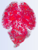 image of mouse brain with extensive blood vessel lesions marked in red
