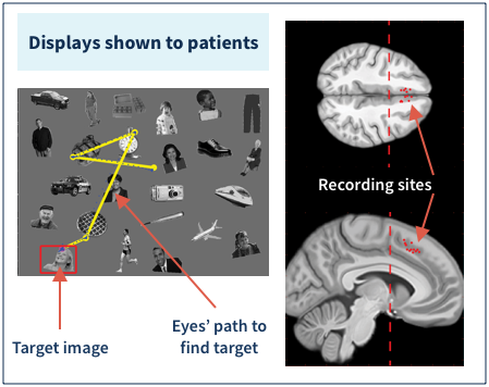 Images of people and things shown to patients during experiment. Brain imaging with recording sites identified.