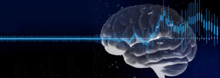 Photo of a neurological response to a sensory stimulus.