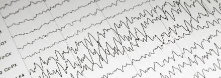 Image of EEG. Focus On Epilepsies banner image.
