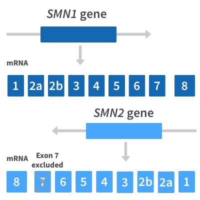 A single nucleotide difference between the SMN1 and SMN2 genes leads to exon 7 skipping.