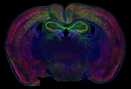 A coronal slice of mouse brain tissue displaying neurons and cell nuclei.