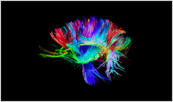 colorful image of human brain