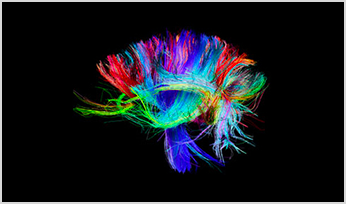 a colorful image of the human brain