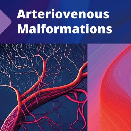 Arteriovenous malformations publication cover image