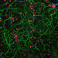 Cultured cells
