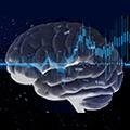 Photo of a neurological response to a sensory stimulus.