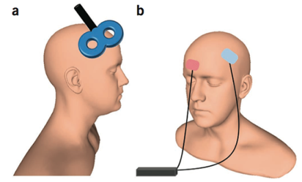 Treat Pain With Non-Drug Non-Invasive Electrical Stimulation