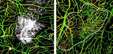 Watching the brain's lining get repaired in mice