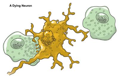 Dying Neuron