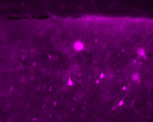 interneurons