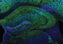 Green neurons in a mouse brain.