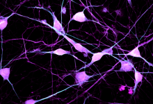 Image showing fluorescent-stained neurons with magenta βIII-Tubulin and cyan MAP2 against a black background.