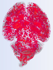image of mouse brain with extensive blood vessel lesions marked in red