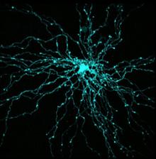 microscopic image of neurons
