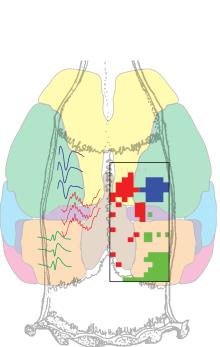 Illustration of the NeuroGrid in a diagram of the brain