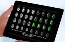 Picture of brain scans used to guide emergency stroke treatment.
