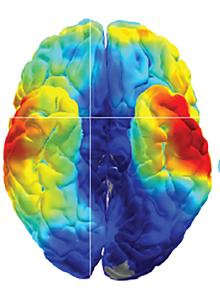 image of the human brain