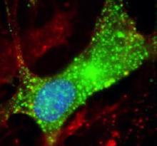 image of leiomodin-1 inside human brain cell
