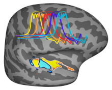 Human brain showing hearing centers