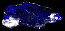 This image shows the brain of a mouse with cerebral malaria. White regions (left, brainstem and right, olfactory bulb) indicate areas of neuronal cell death and vascular leakage.