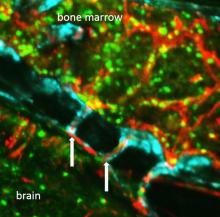 channels in the brain allow immune cells through