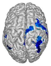 Depiction of a human brain. Blue coloring identifies the areas where resting brain activity appeared to correlate with learning new skills.