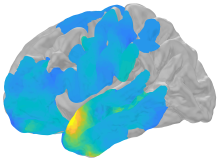Picture of a brain. Yellow spots show parts of brain where ripples happen seconds before successful memory recall.