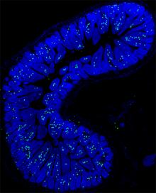 fluorescent staining of mouse intestine showing increased IL-17 expression after high-salt diet