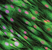 Picture cells colored in green with reddish pink spots.