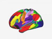 Multi-colored, side view picture of the brain. Colors represent different areas.