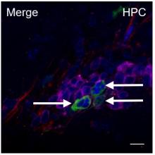 Image showing HIV infection of CD4+ T cells in the mouse brain. (red), Human T cells (magenta), human astrocytesHIV (green), nuclei (Blue). Arrows identify uptake of HIV from astrocytes into T cells.