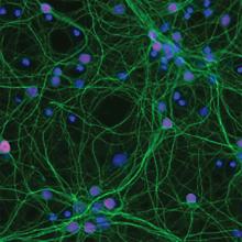 Neurons in a culture dish used to find genetic suspects of ALS and FTD