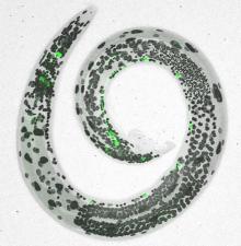 Worm from study on stress and nervous system