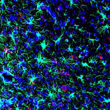 Picture of Zika-infected mouse brain from NIH study that looked for effective anti-viral treatments.