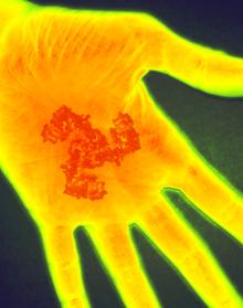 Picture of hand undergoing inflammation and PIEZO2 gene, which controls pain caused by inflammation after skin injury.