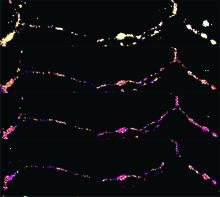 Four shots of the same neuron, each colored differently. The colors represent changing energy levels during neural communication.