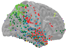 Side view of a brain. Colored dots represent electrodes used to record brain waves.