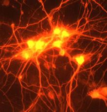 microscopic image of new connections forming in neurons