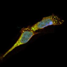 image of cell containing active LRRK2 protein