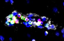 Image of immune cells accumulating in brain blood vessels