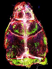 Image of immune cells in the mouse brain