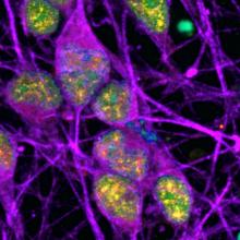 fluorescent image of neurons showing activation of DNA repair pathways