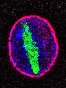 Image of a genetic mutation implicated in ALS and FTD preventing proteins from entering and exiting the cell’s nucleus  