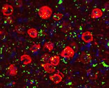 microscopic image of Proteasomes and Brain Cell Death