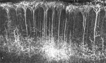 image of neural activity in a rat's brain