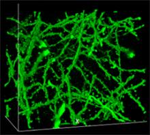 Magnified image of brain cells swollen by the superabsorbant diaper compound polyacrylate