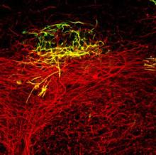 Image showing blockade to repair of white matter injury.