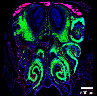 Microglia in the olfactory bulb have a nose for protecting the brain from infection. Credit: McGavern lab